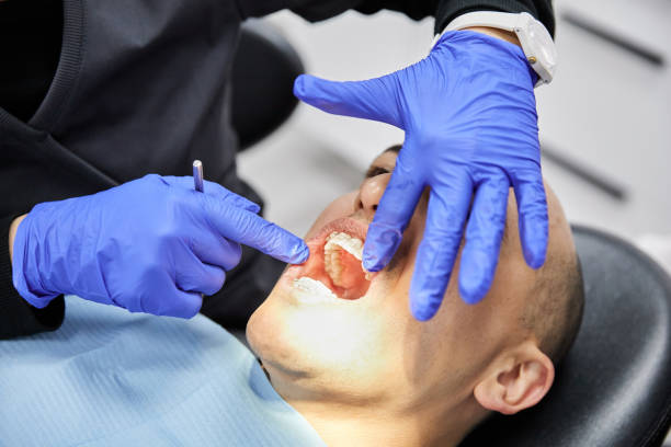 Best Emergency Gum Treatment in Timberwood Park, TX